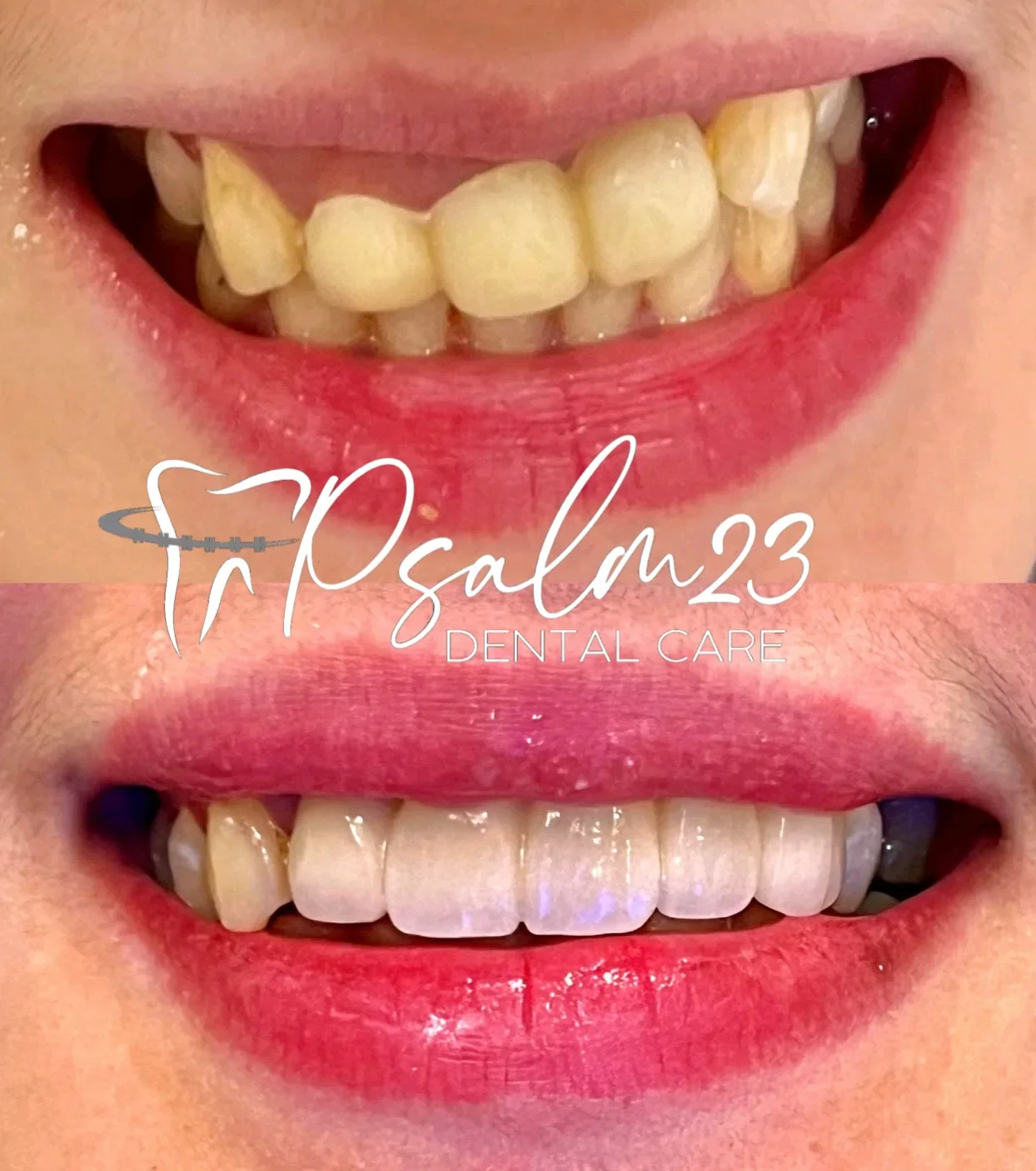 Psalm23 Dental Care cosmetic dentistry services — photo 2